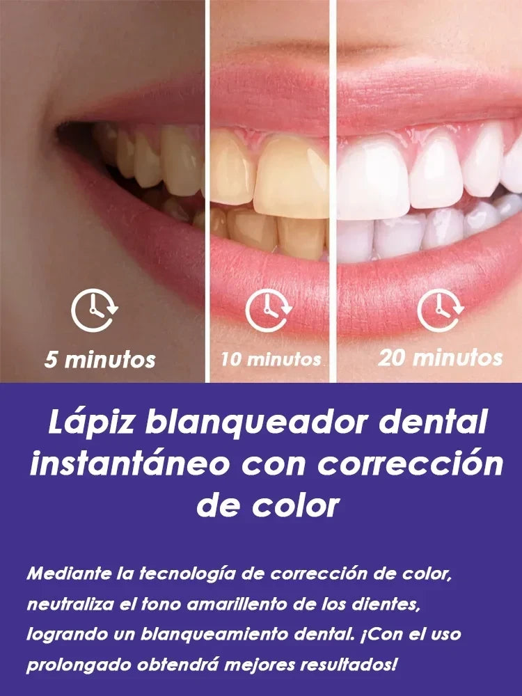 Purple Instant Teeth Whitening Pen